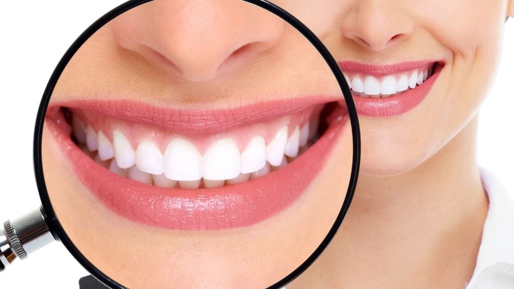 Blanqueamiento Dental