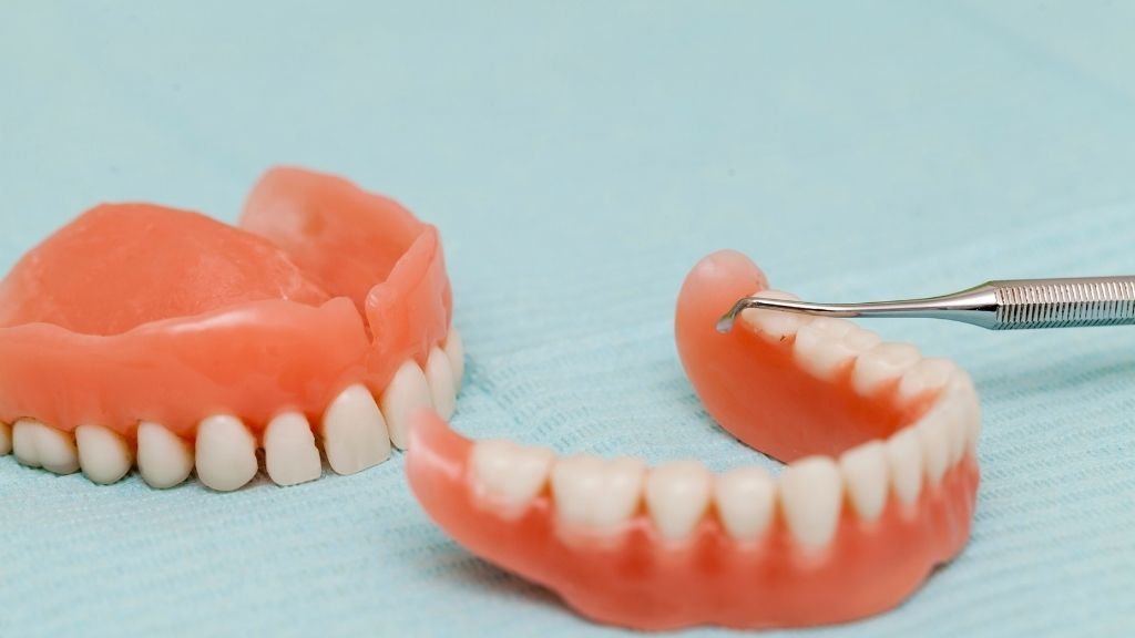 Prótesis dental fija