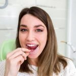 Retenedores de Ortodoncia