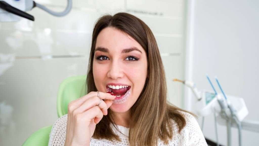 Retenedores de Ortodoncia