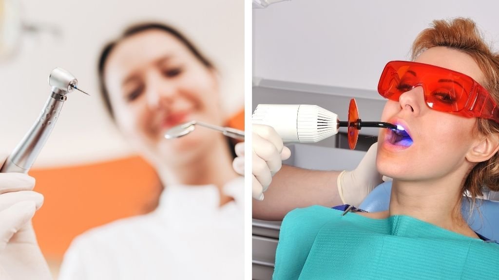 Cómo se hace un empaste dental