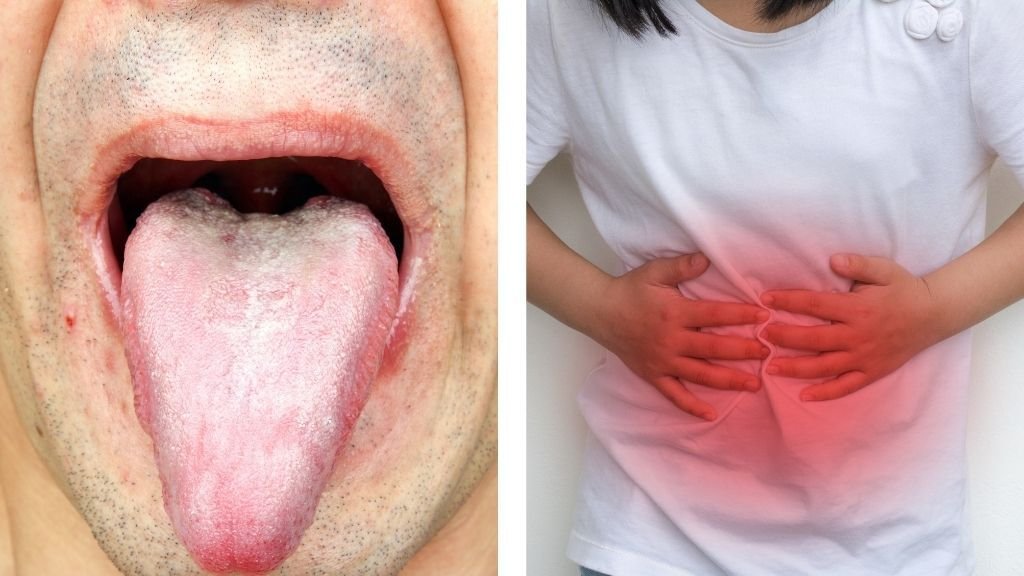 Lengua blanca hígado y estómago