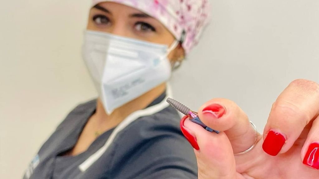 Mejores marcas de implantes dentales