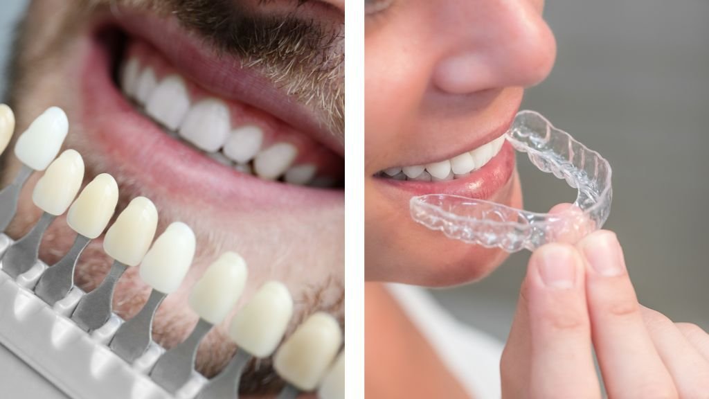 Ortodoncia o Carillas