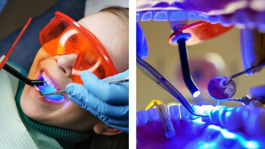 Tratamiento Caries Dentales