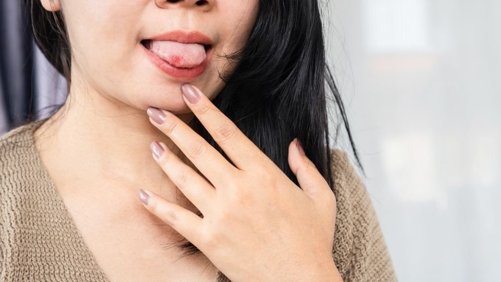 Llagas o heridas en la lengua: causas y tratamiento