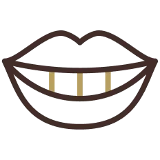 Brackets en Alicante