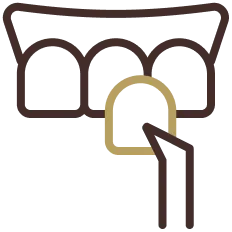 carillas dentales en Alicante