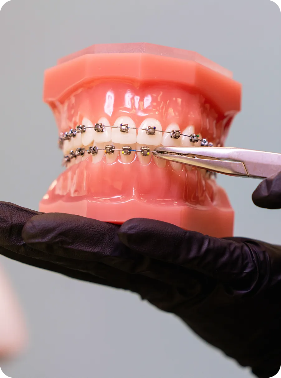 Brackets en Alicante